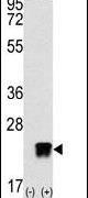 ARL3 Antibody in Western Blot (WB)
