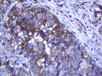 ARMC1 Antibody in Immunohistochemistry (Paraffin) (IHC (P))