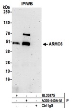 ARMC6 Polyclonal Antibody