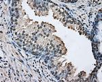 ARNT Antibody in Immunohistochemistry (Paraffin) (IHC (P))