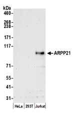 ARPP21 Polyclonal Antibody