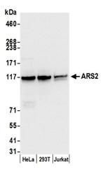 ARS2 Antibody in Western Blot (WB)