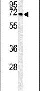 ARSI Antibody in Western Blot (WB)