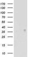 ART1 Antibody in Western Blot (WB)