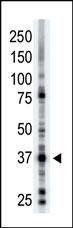 ART1 Antibody in Western Blot (WB)