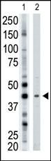 ART3 Antibody in Western Blot (WB)