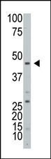 ART3 Antibody in Western Blot (WB)