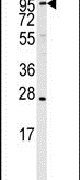 ARTS1 Antibody in Western Blot (WB)