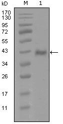 Androgen Receptor Monoclonal Antibody (1A9D12)