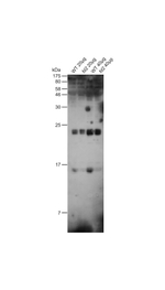 FDX1/Ferredoxin Antibody in Western Blot (WB)