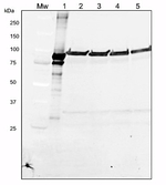 LOX/Lipoxygenase Antibody in Western Blot (WB)