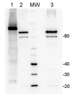 LOX/Lipoxygenase Antibody in Western Blot (WB)