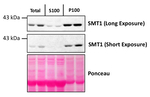 SMT1/Sterol methyltransferase 1 Polyclonal Antibody
