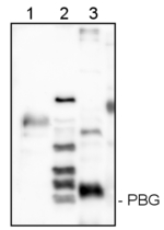 HemC/Porphobilinogen-Deaminase (PBG) Polyclonal Antibody