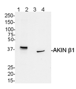AKINB1/SNF1-related protein kinase regulatory subunit beta-1 Polyclonal Antibody