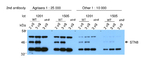STN8/Serine/threonine-protein kinase STN8 (chloroplastic) Polyclonal Antibody