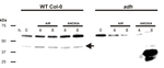 ADH/Alcohol dehydrogenase (hypoxia marker) Polyclonal Antibody