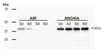 ADH/Alcohol dehydrogenase (hypoxia marker) Antibody in Western Blot (WB)