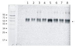 PsaB/PSI-B core subunit of photosystem I Antibody in Western Blot (WB)