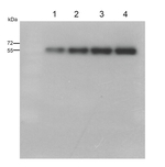 PsaB/PSI-B core subunit of photosystem I Antibody in Western Blot (WB)
