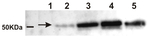 AMY/Alpha-amylase Polyclonal Antibody