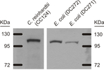ADH/ALDH/Alcohol/acetaldehyde dehydrogenase Polyclonal Antibody