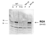RGA/DELLA protein RGA Antibody in Western Blot (WB)