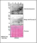 GAI/DELLA protein GAI Polyclonal Antibody