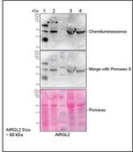 RGL2/RGA-like protein 2 (DELLA protein) Antibody in Western Blot (WB)