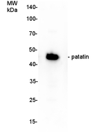 Patatin Antibody in Western Blot (WB)