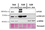 FLS2/Flagellin-sensitive 2 Antibody in Western Blot (WB)