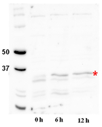 DGAT2A/Acyl-CoA: Diacylglycerol acyltransferase Polyclonal Antibody
