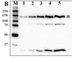 CrPDAT1/Phospholipid: diacylglycerol acyltransferase Polyclonal Antibody