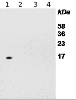RPS14/40S ribosomal protein S14-1 Antibody in Western Blot (WB)