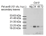 PR-4/Pathogenesis-related protein 4 Antibody in Western Blot (WB)