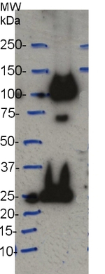 CesA7 (IRX3)/Cellulose synthase A catalytic subunit 7 (UDP-forming) Polyclonal Antibody