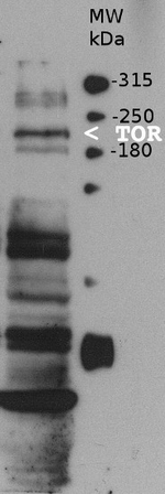 TOR/Target of rapamycin Antibody in Western Blot (WB)