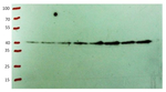 CHS/Chalcone synthase Polyclonal Antibody