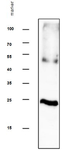 TIP2/Tonoplast intrinsic protein 2.1, 2.2, 2.3 Polyclonal Antibody