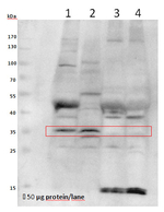 VPS26A/Vacuolar protein sorting 26A Polyclonal Antibody