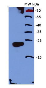 Calcineurin/EF-hand motif Polyclonal Antibody