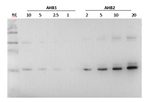 AHB2/Hemoglobin 2 Polyclonal Antibody