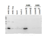 AHB2/Hemoglobin 2 Antibody in Western Blot (WB)