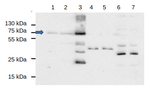 EDS1/Enhanced disease susceptibility 1 Antibody in Western Blot (WB)