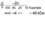 ZCP1/Zinc Chaperone Protein Antibody in Western Blot (WB)
