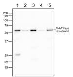 V-ATPase, B/vacuolar H-ATPase subunit B Polyclonal Antibody