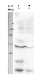 U1 snRNP protein A/U1 small nuclear ribonucleoprotein A Polyclonal Antibody