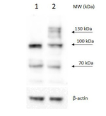 PRP40B/pre-mRNA-processing protein 40B Antibody in Western Blot (WB)