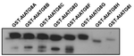 ATG8A-I/Autophagy-related protein 8A-I isoforms Antibody in Western Blot (WB)