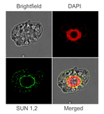 SUN1,2 (nuclear envelope protein) Polyclonal Antibody